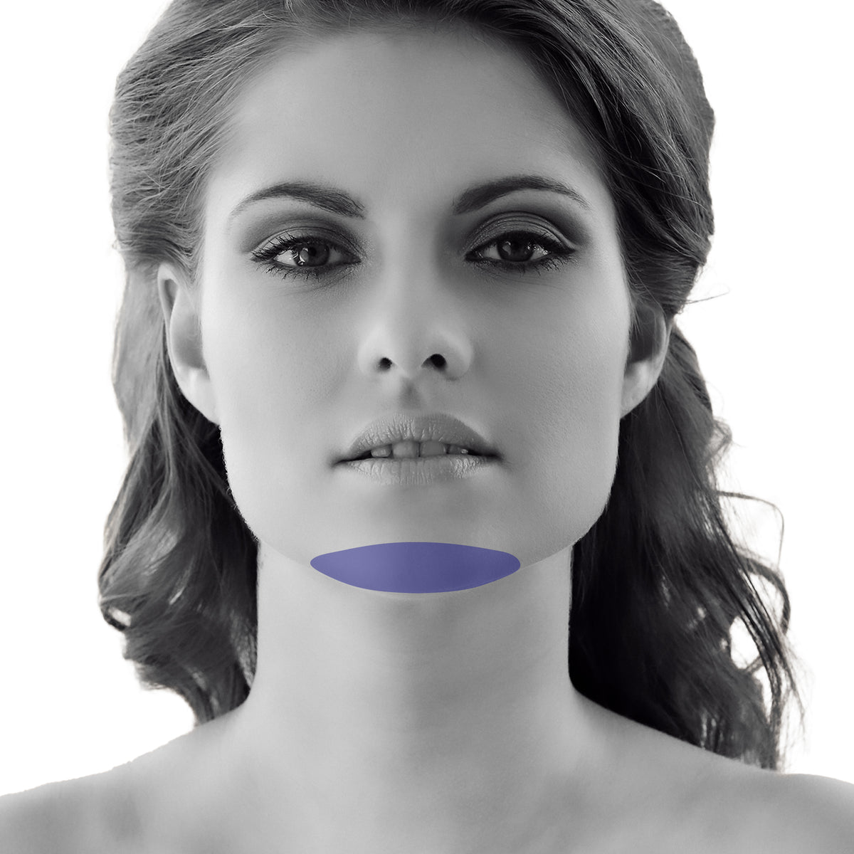Chin Laser Hair Removal For Women