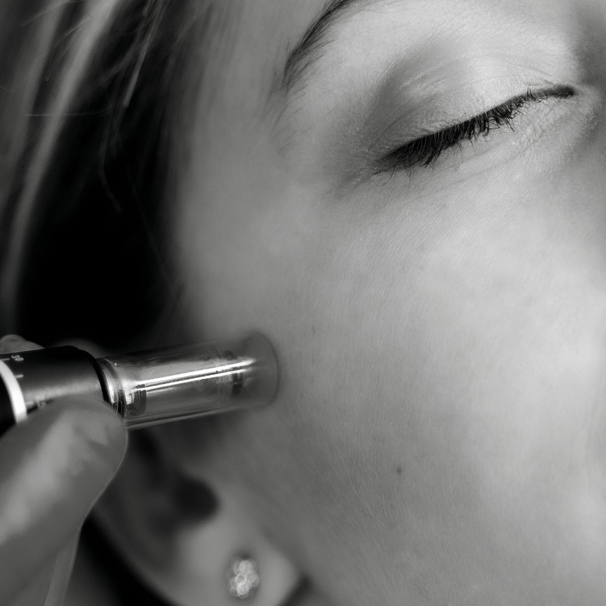 SkinPen® Microneedling (60 minutes)