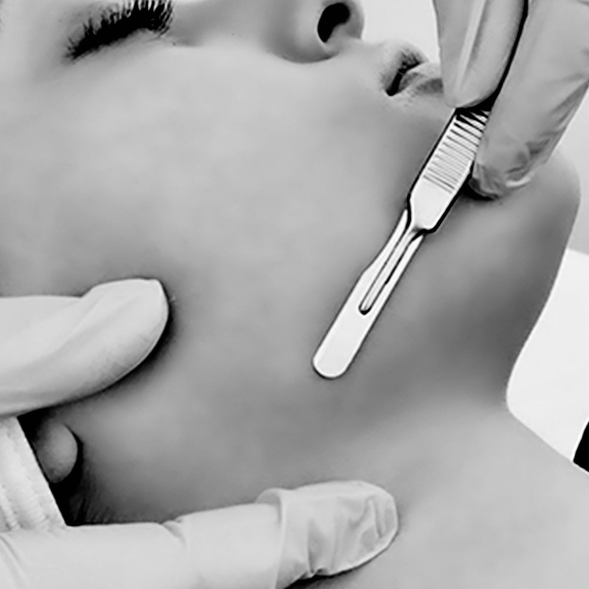 Dermaplaning (40 minutes)