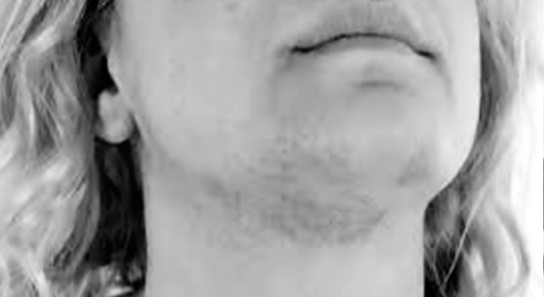 UNDERSTANDING THE CONNECTION BETWEEN THYROID HEALTH AND FACIAL HAIR GROWTH