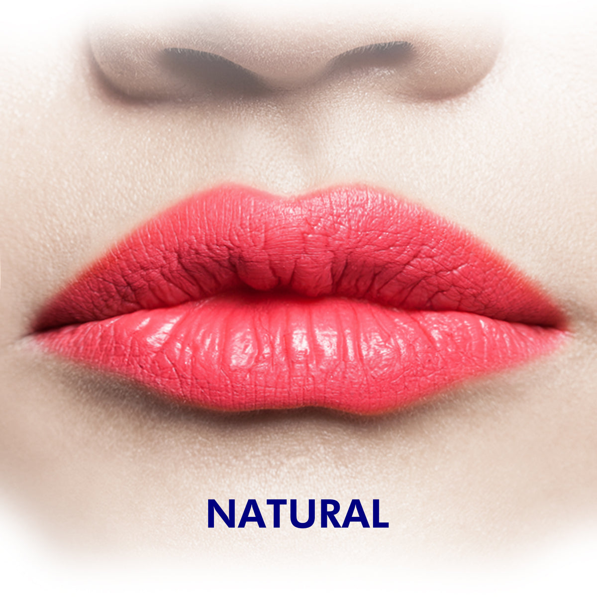 Fillers (Radiesse & Versa) (One Syringe)