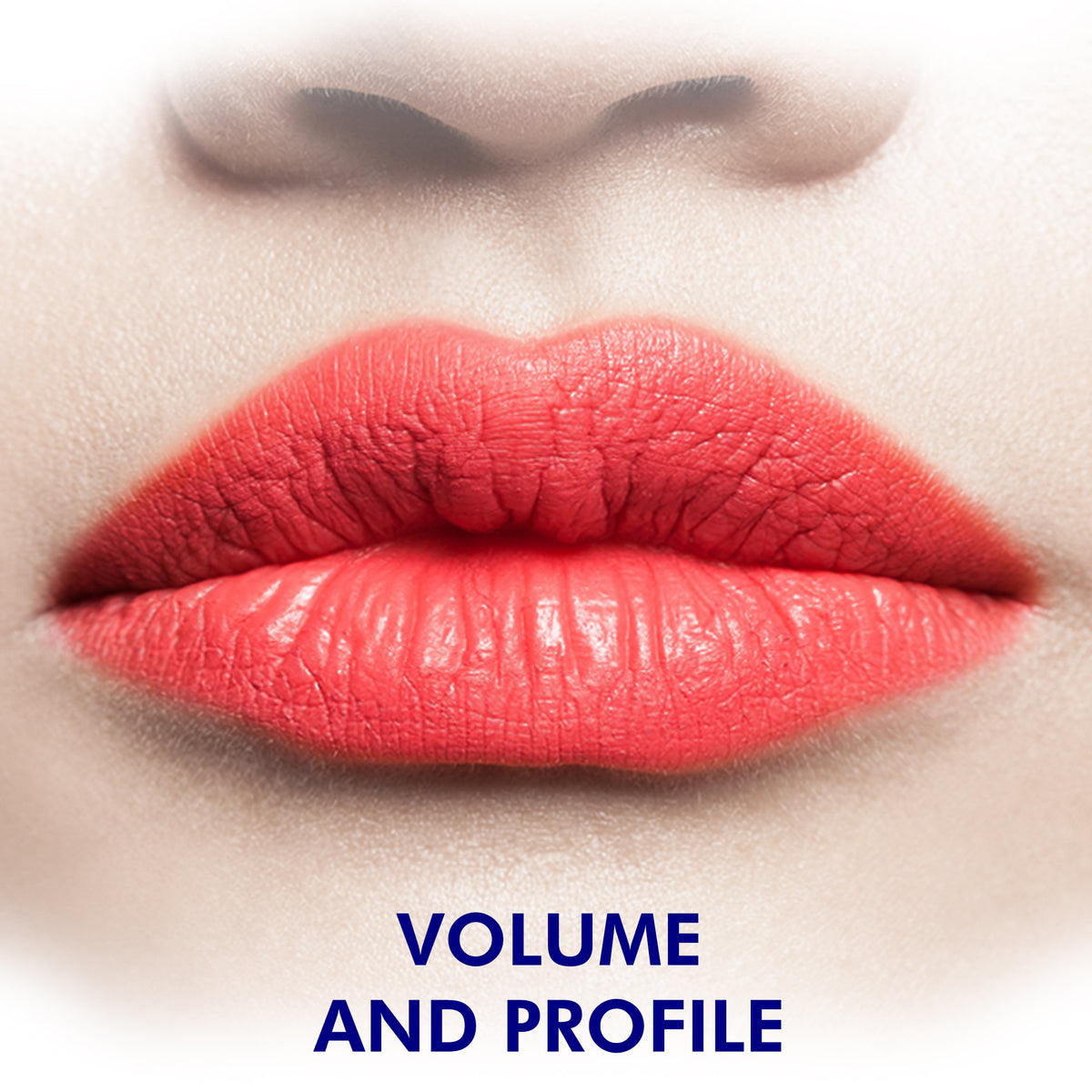 Fillers (Radiesse & Versa) (One Syringe)