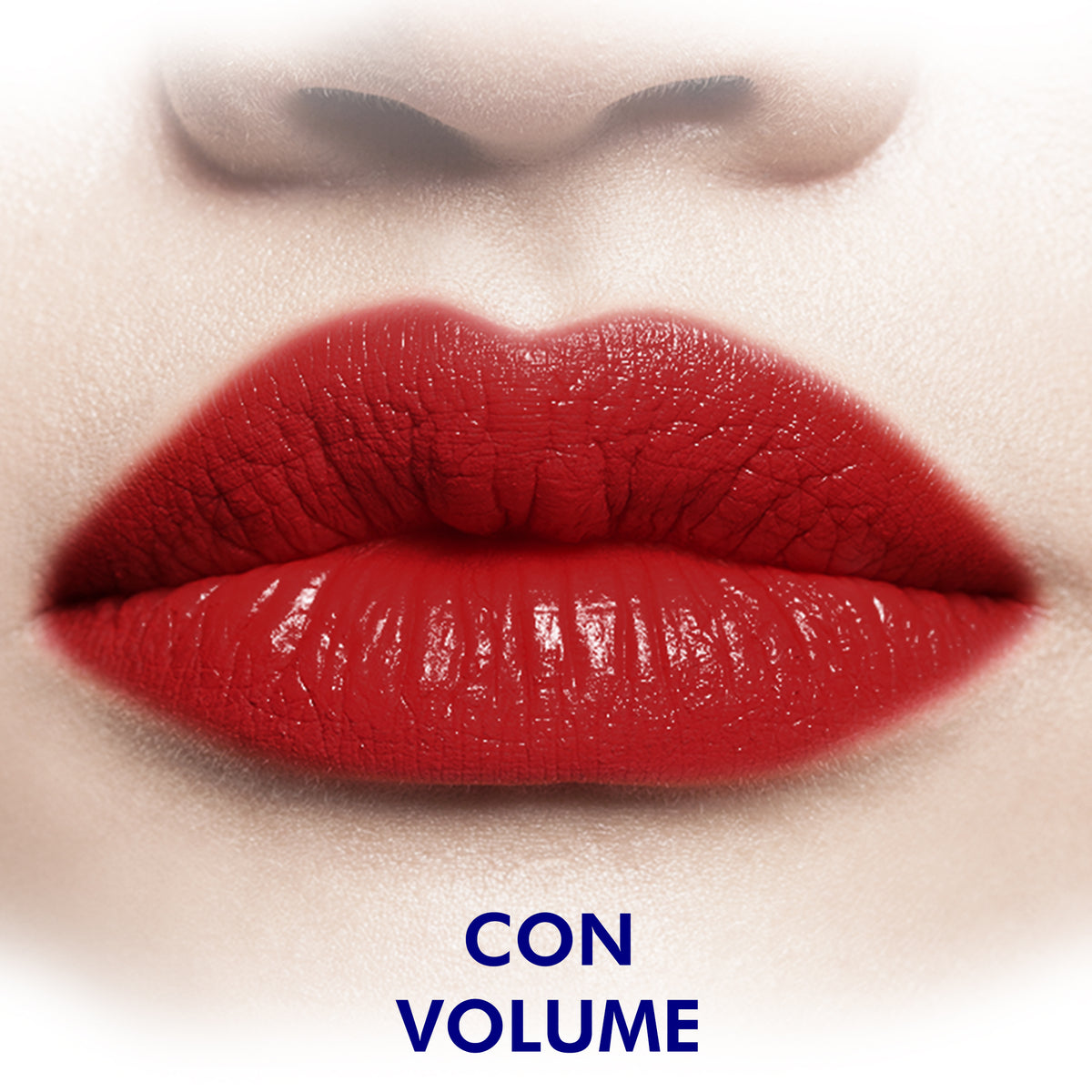 Fillers (Radiesse & Versa) (One Syringe)