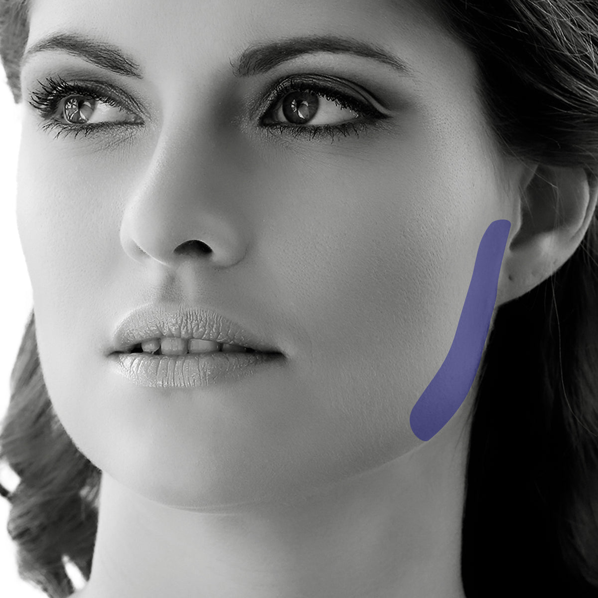 Sideburn Laser Hair Removal for Women