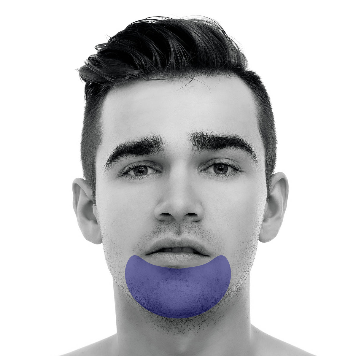 Extended Chin Laser Hair Removal For Men