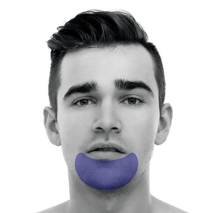 Extended Chin Laser Hair Removal For Men