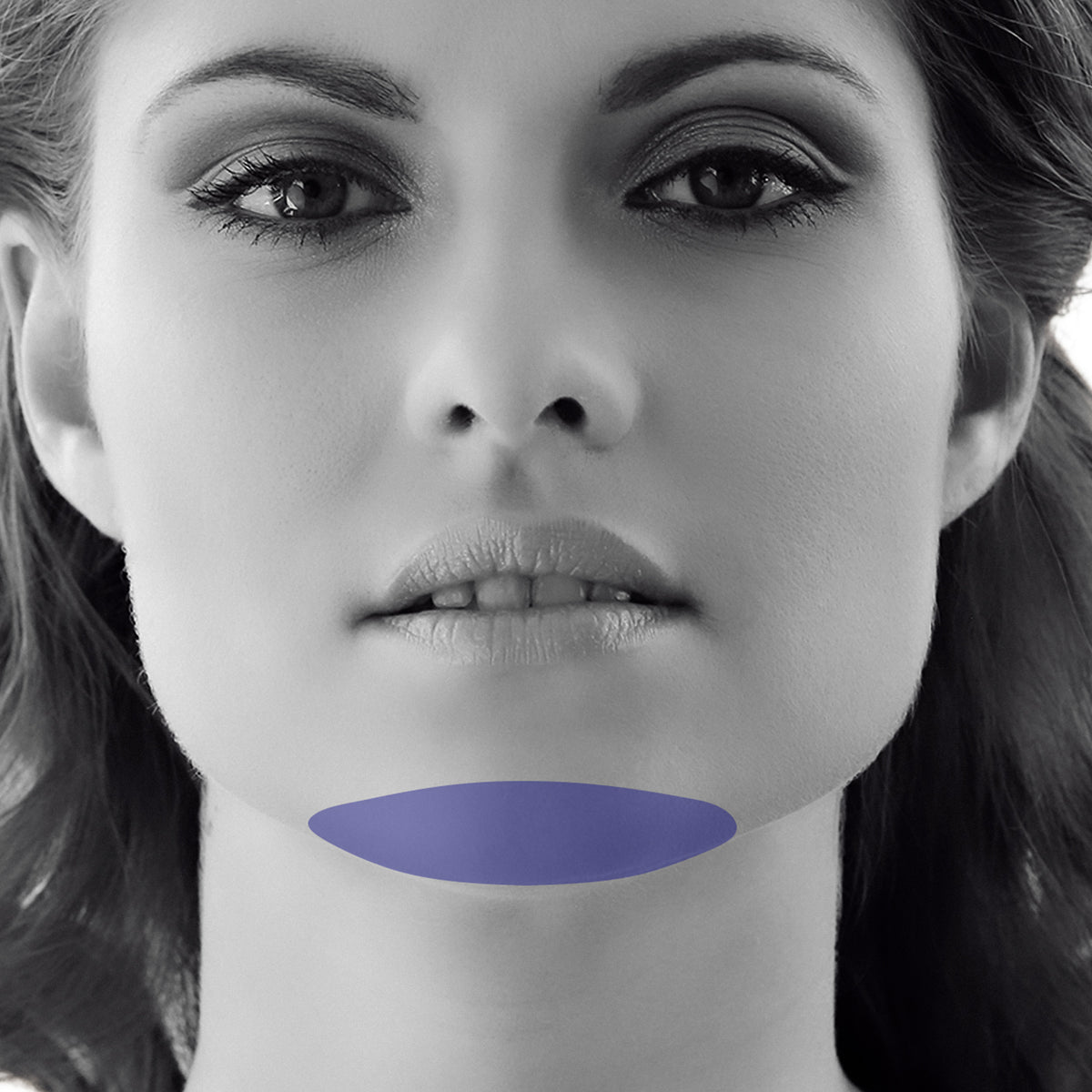 Chin Laser Hair Removal For Women