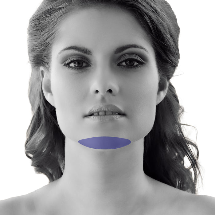 Chin Laser Hair Removal For Women