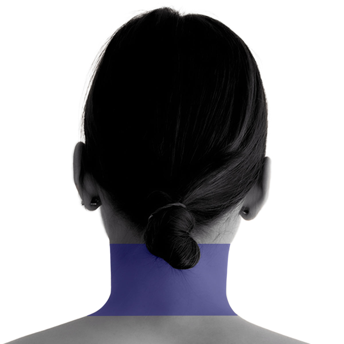 Back Neck Laser Hair Removal For Women