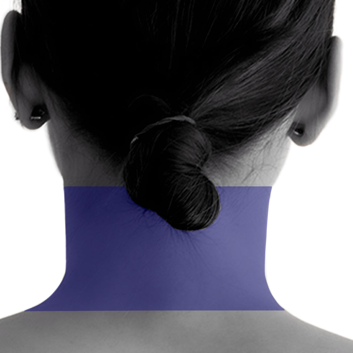 Back Neck Laser Hair Removal For Women