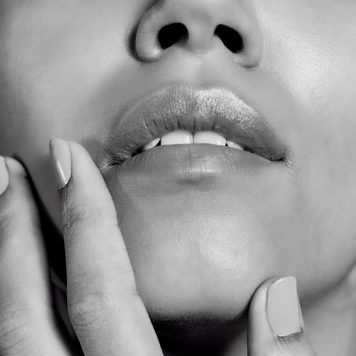 Fillers (Radiesse & Versa) (One Syringe)