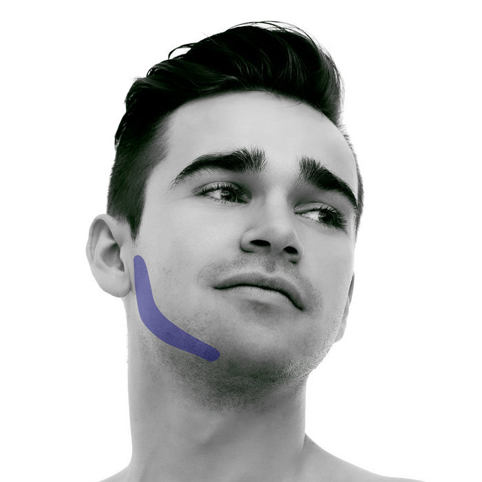 side-burn Laser Hair Removal for Men
