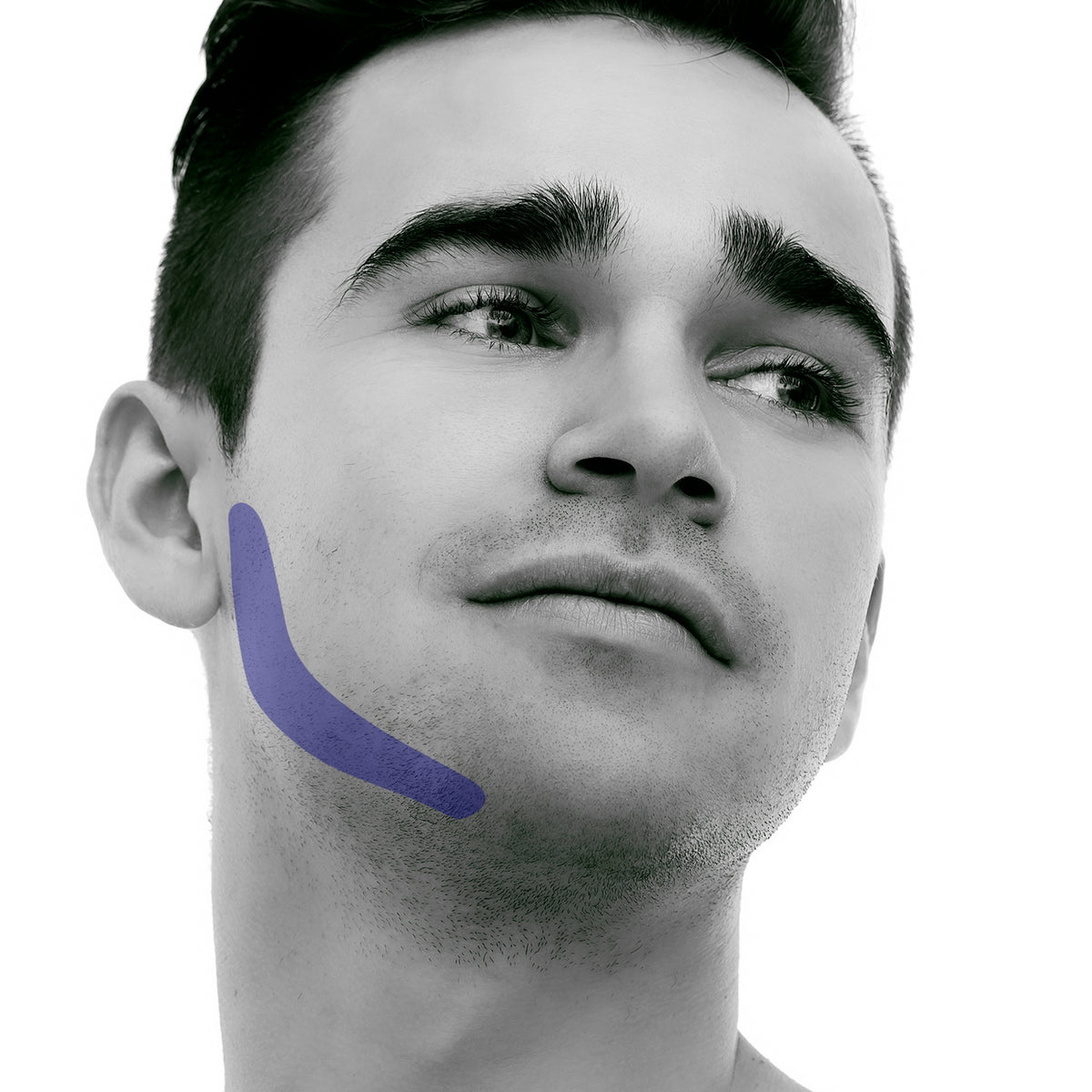 side-burn Laser Hair Removal for Men
