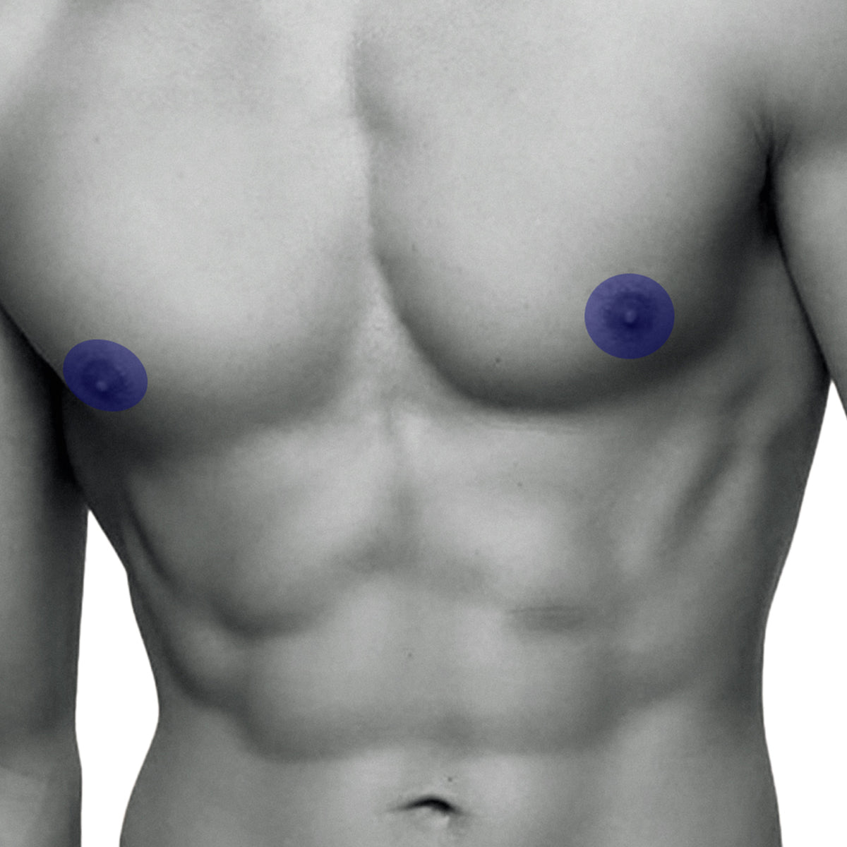 Areola Laser Hair Removal Men