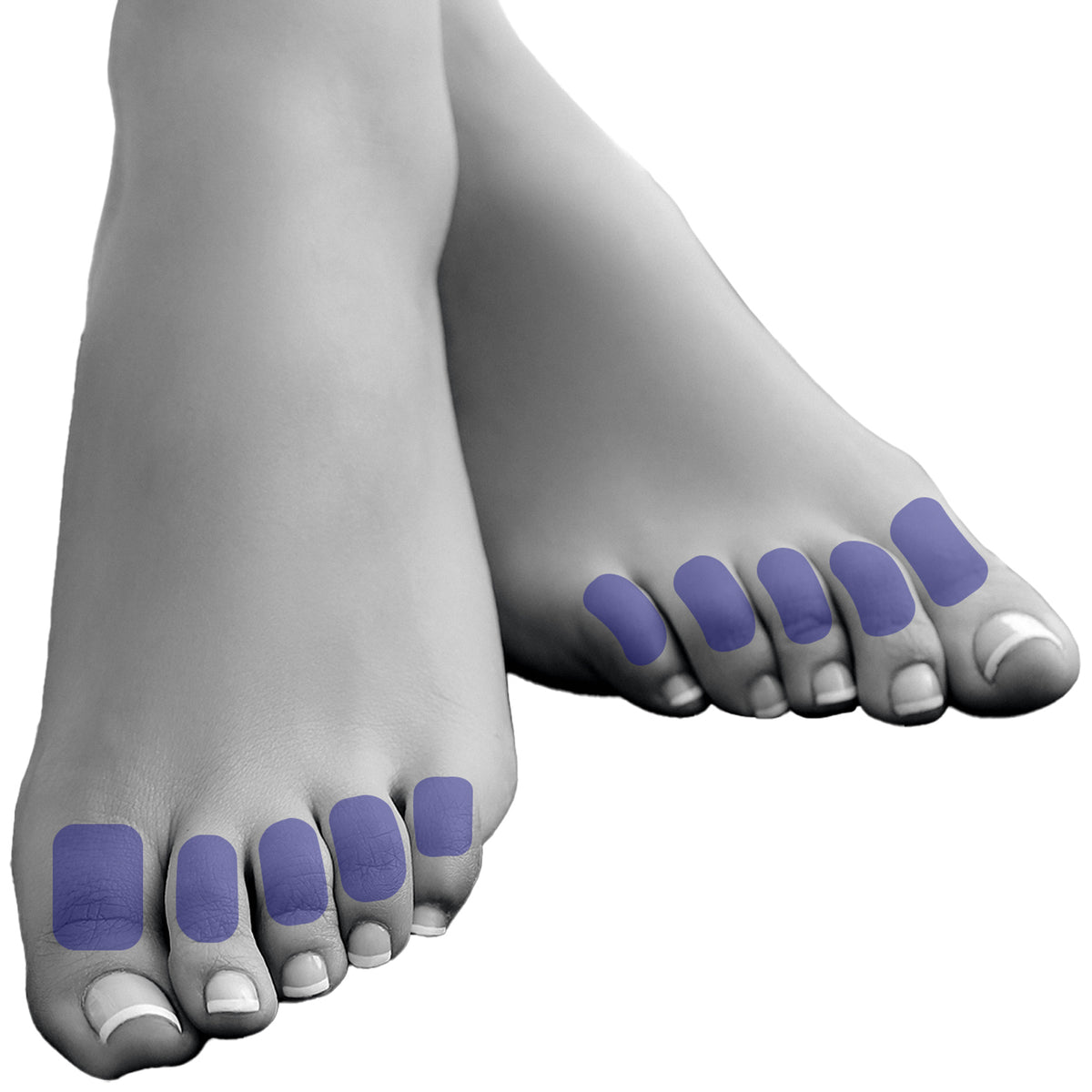 Toes Laser Hair Removal For Women